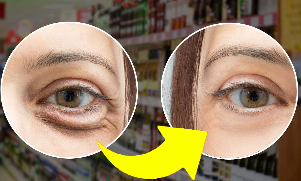 Creme antirughe: scopri la migliore! Lidl tra i peggiori nella classifica del test – Scopri di più!
