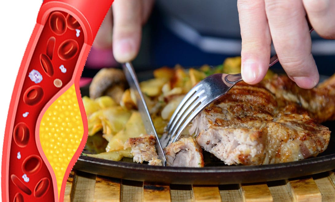 Colesterolo alto? 6 super alimenti proteici per sostituire la carne!